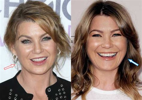 Ellen pompeo face surgery. Things To Know About Ellen pompeo face surgery. 